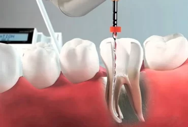 Endodoncija